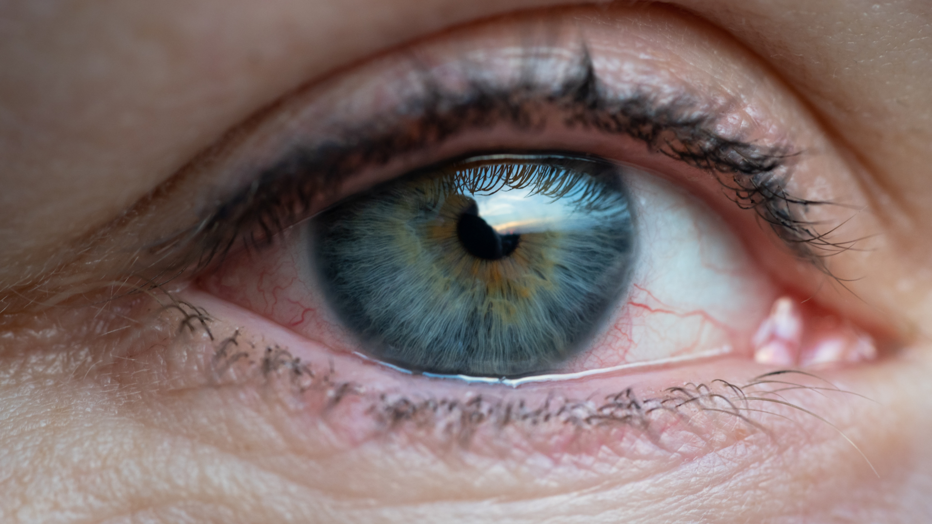Quais são os sintomas do olho seco?