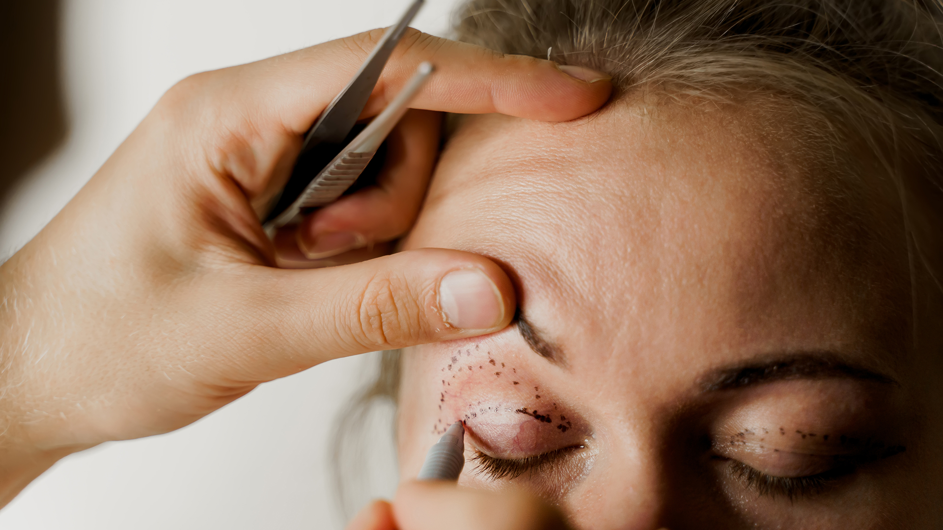 Quais os benefícios da plástica ocular?