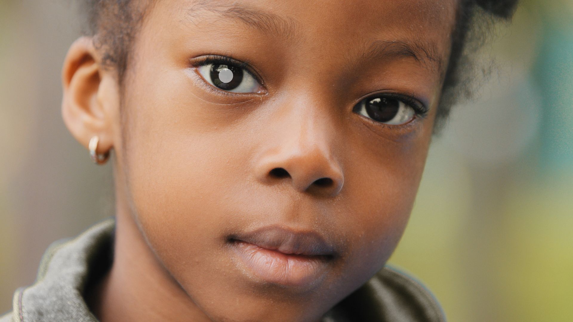 Fique atento e conheça os sintomas do Retinoblastoma