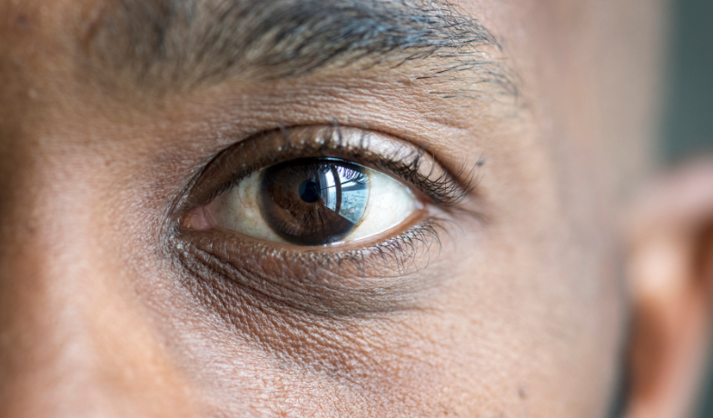 Doenças que causam cegueira: prevenção e diagnóstico precoce